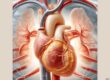 Die Darstellung zeigt das menschliche Herz mit den Hauptblutgefäßen und hebt die verdickte und geschwächte Stelle der aufsteigenden Aorta hervor.