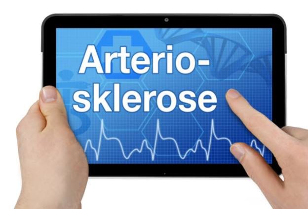 Aorta Arteriosklerose