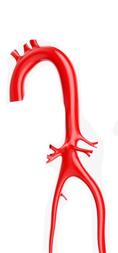 Aorta Erkrankung