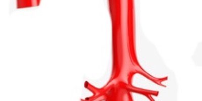 Aorta-Hauptschlagader Aorta Hauptschlagader