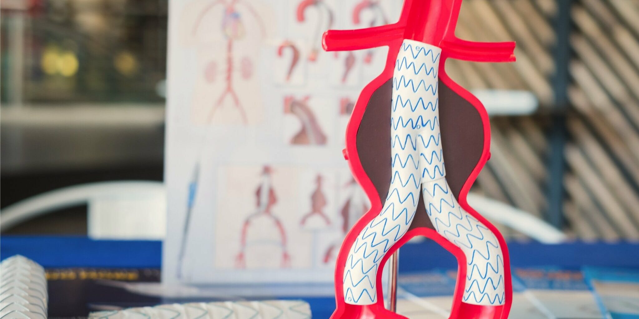 leben-mit-einem-aneurysma-an-der-aorta Leben mit einem Aneurysma an der Aorta