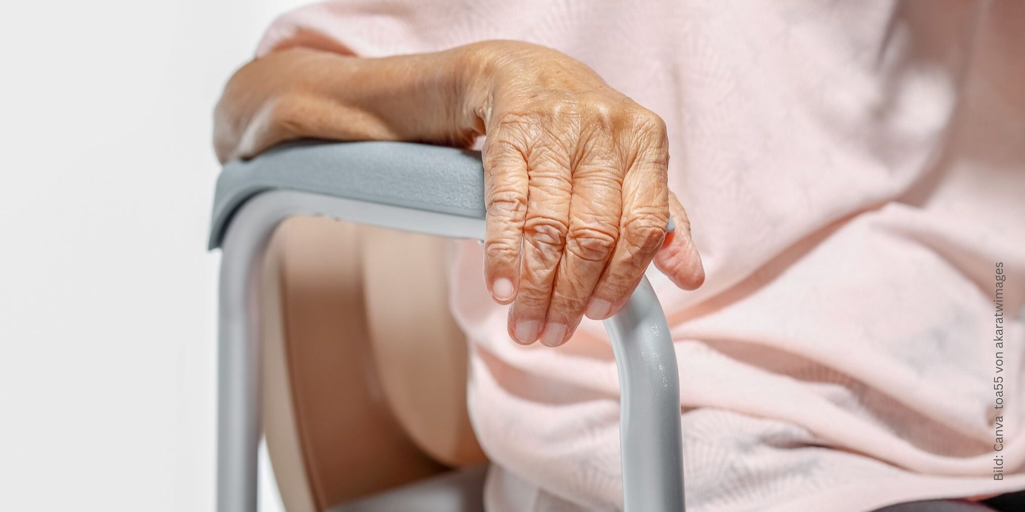 frailty-syndrom-gebrechlichkeit-als-herausforderung-in-der-gefaesschirurgie Arm einer alten Frau auf einer Stuhllehne zum Thema Frailty Syndrom - wie Altersgebrächlichkeit die Gefäßchirurgie beeinflusst.