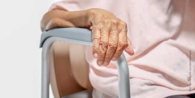 Arm einer alten Frau auf einer Stuhllehne zum Thema Frailty Syndrom - wie Altersgebrächlichkeit die Gefäßchirurgie beeinflusst.